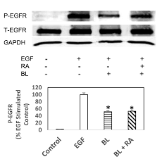 Care homes can reduce the stress of looking after your health and care. Rosmarinic Acid Blue Light Combination Treatment Inhibits Head And Neck Squamous Cell Carcinoma In Vitro Anticancer Research