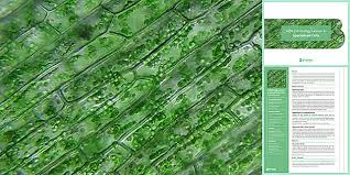Is elodea eukaryotic or prokaryotic. Aqa Gcse Cell Biology Lesson 4 Specialised Cells Beyond