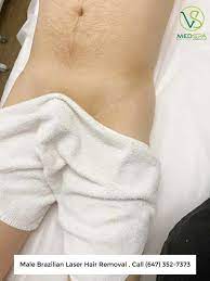 In order to help you get more info about laser hair removal for especially for men, excessive hair can cause itching and irritation. Brazilian Laser Hair Removal For Men Vs Medspa Laser Clinic