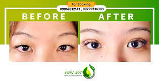 State of the art medical equipment. Skin Art Aesthetic And Laser Clinic Facebook