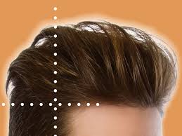 All hair transplant clinics worldwide. My Hairline Threatened My Identity So Much The Ground Felt Shaky Why Hair Transplants Are Booming Men S Hair The Guardian