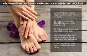 Wie Lange Dauert Es Bis Ein Entfernter Nagel Nachgewachsen Ist