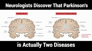 Shahidi ga, rohani m, parvaresh m. Neurologists Discover That Parkinson S Is Actually Two Diseases