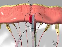 Pin By Dr Mustafa Mohamed On Medical Make It Simple Simple Made