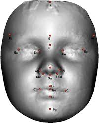 Winnipegger faces asperger's syndrome with comedy. Autistic Boys And Girls Found To Have Hypermasculinised Faces Supporting The Extreme Male Brain Theory Research Digest