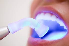 Oral cancer can pose a serious health risk.consequently, many patients become concerned when they develop unusual spots or sores in the mouth. How Can You Prevent Oral Cancer Northside Dental Raleigh Nc