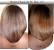 Biotin Results Skin