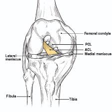 Some types of leg pain can be traced to problems in your. Acl Tear Q A Causes Diagnosing Treatment