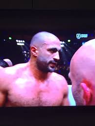 Check spelling or type a new query. Babette Boogers Auf Twitter Zou Badr Hari Ook Een Ossatecnodig Hebben Ossatec Snellerherstellen Bonegrowthstimulator