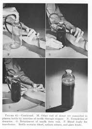 Image result for Plasma Transfusion