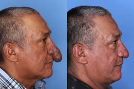 Rifó su camioneta para pagar una costosa cirugía, pero el ganador decidió  devolvérsela