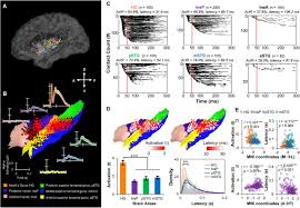 Chapter 5 10 months ago. Revealing The Functions Of Supra Temporal And Insular Auditory Responsive Areas In Humans Biorxiv