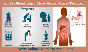 The cure for stomach cancer depends on how long the patient has been affected by the disease. Medical Tourism Magazine All You Should Know About Stomach Cancer Treatment