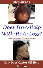 Hair Loss How Much Body Hair Is Loss From Estrogen Trans Labrador Retriever Hair Loss Kenalog Side Effec Hair Loss Women Dht Hair Loss Best Hair Loss Treatment