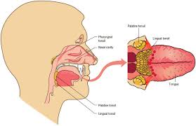 Tonsils protect the body against bacterial and viral infection they block microbes such as bacteria, viruses and fungi. Tonsillitis Tonsillectomy S Cool Cure What Is Tonsillitis Who Gets Tonsillitis Can Tonsillitis Be Prevented