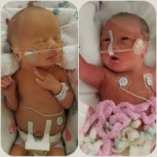 🍼✨ Spotlight Babies of the Day: Meet Cora & Parker! ✨🍼 These are my  incredible preemie twin girls! 💕 Cora and Parker were born at exactly 30  weeks and will be turning