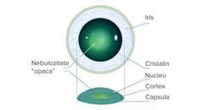 We did not find results for: Cataracta Optica Medicala Pitesti Oftalmologie Pitesti Clarissoptiq Ro