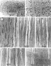 Image result for Pygmaeothamnus zeyheri