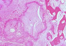 Maybe you would like to learn more about one of these? Webpathology Com A Collection Of Surgical Pathology Images