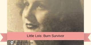 Little Lois: Burn Survivor