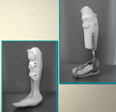 Check spelling or type a new query. Cast Splints Flashcards Quizlet