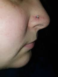 I Cannot Get Rid Of The Bump Irritation Around My Nostril Piercing I Need Advice Piercing