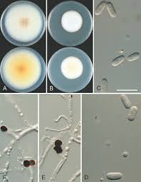 Image result for Colletoecema