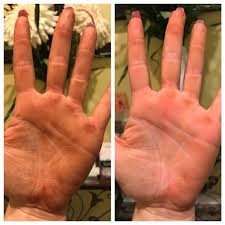 Get Spray Tan Off With Windex Spray Tanning Fake Tan Face And Body