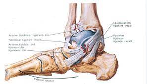 Pin By Elizabeth Vaughan On Health Ankle Anatomy Sprained Ankle Sprain