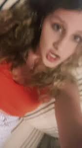 Sunkissed or sun burnt