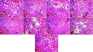 Image result for Englerina woodfordioides