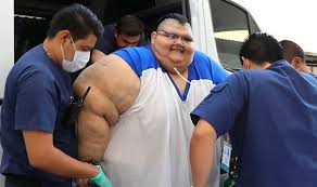 Juan pedro franco went from facing one enemy to another: World S Heaviest Man Goes Under Knife In Mexico News Emirates24 7