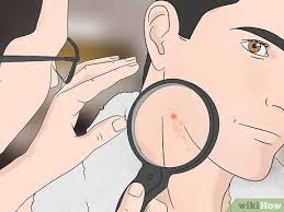 Stop the itching with our powerful. 3 Ways To Stop Itching After Shaving Wikihow