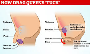 Or, the cause of a symptom may be a different medical condition that. Transwoman Forced To Have Testicle Removed After Years Of Tucking Daily Mail Online