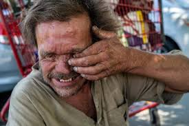 California fails to help this blind homeless man in crisis