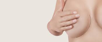 Poland syndrome is characterized by partial or complete absence of the major pectoral muscle (pectoralis major). Poland Syndrome Axilleas Xantes Plastikos Xeiroyrgos