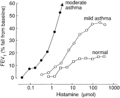 Image result for Inhalation Challenge Test