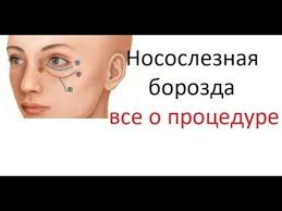 как быстро убрать синяк на лице в домашних условиях Pin Na Doske Zdorove