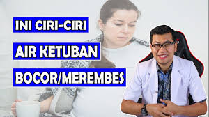 Cara mengatasi air ketuban sedikit wajib ibu hamil ketahui guna meminimalisasi risiko buruk yang memungkinkan terjadi pada janin yang di kandung. Ciri Ciri Ketuban Merembes Atau Bocor Dr Saddam Ismail Youtube