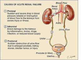 Acute Renal Failure Nursing Care Plan Management Rnpedia Nurse Nursing Students Nursing Mnemonics