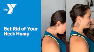 (… it's a protruding bone at base of neck . Get Rid Of Your Neck Hump Youtube