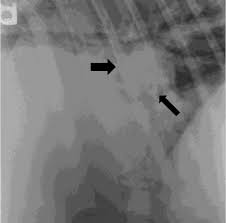 Image result for Rhodococcus equi