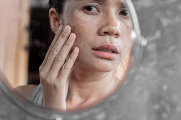 Nội tiết tố nữ &ndash; Những nguy cơ phụ nữ cần biết - VIỆT B&Aacute;CH