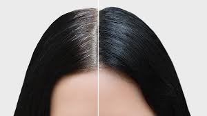 Discussion in 'women's general hair loss discussions' started by devastated, oct 28, 2005. Root Cover Up Sprays To Hide Your Lockdown Regrowth Glossybox