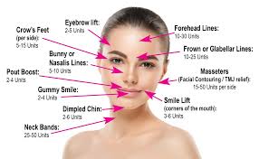 Botox Facial Diagram Wiring Diagrams