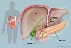 What if your stomach is swollen after gallbladder surgery? answered by dr. Gallbladder Surgery Tips And Tricks Mental Post Its