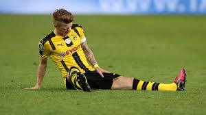 Maybe you would like to learn more about one of these? Borussia Dortmund Mit Personalsorgen Piszczek Schmelzer Ginter Und Reus Fraglich Eurosport