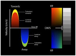 doppler color flow map virtual tee colour color doppler