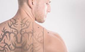 However, it's a process that can be done adjusted to your. 10 Best Ways To Improve Laser Tattoo Removal Process And Fading