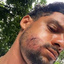 Fundraiser by Rudy Jimenez : Support Rudy after car accident, Ayudá después  su accidente